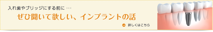 ぜひ聞いてほしい、インプラントの話